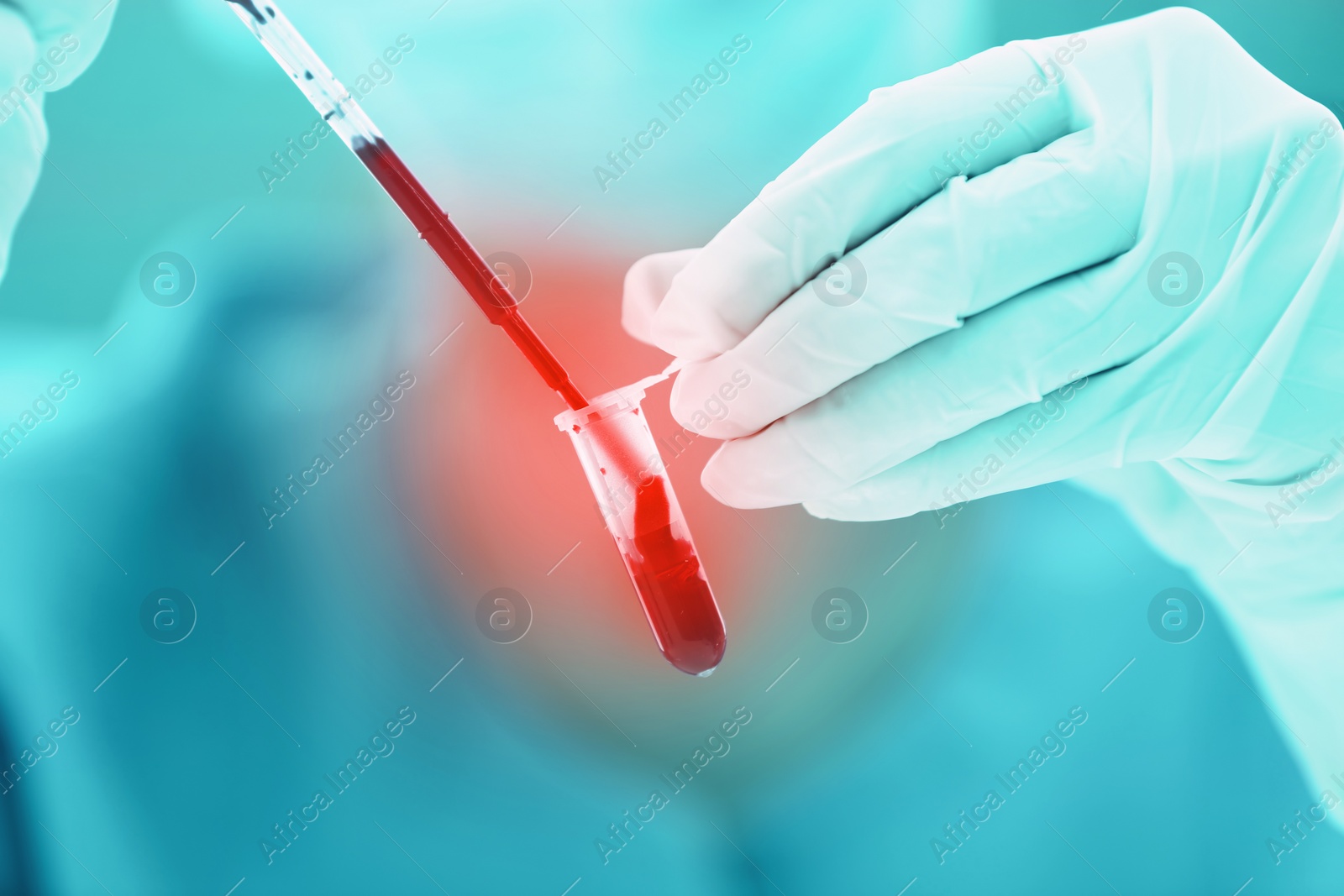 Image of Scientist dripping blood into test tube, closeup. Laboratory analysis