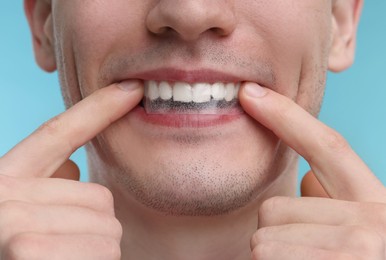 Photo of Young man applying whitening strip on his teeth against light blue background, closeup