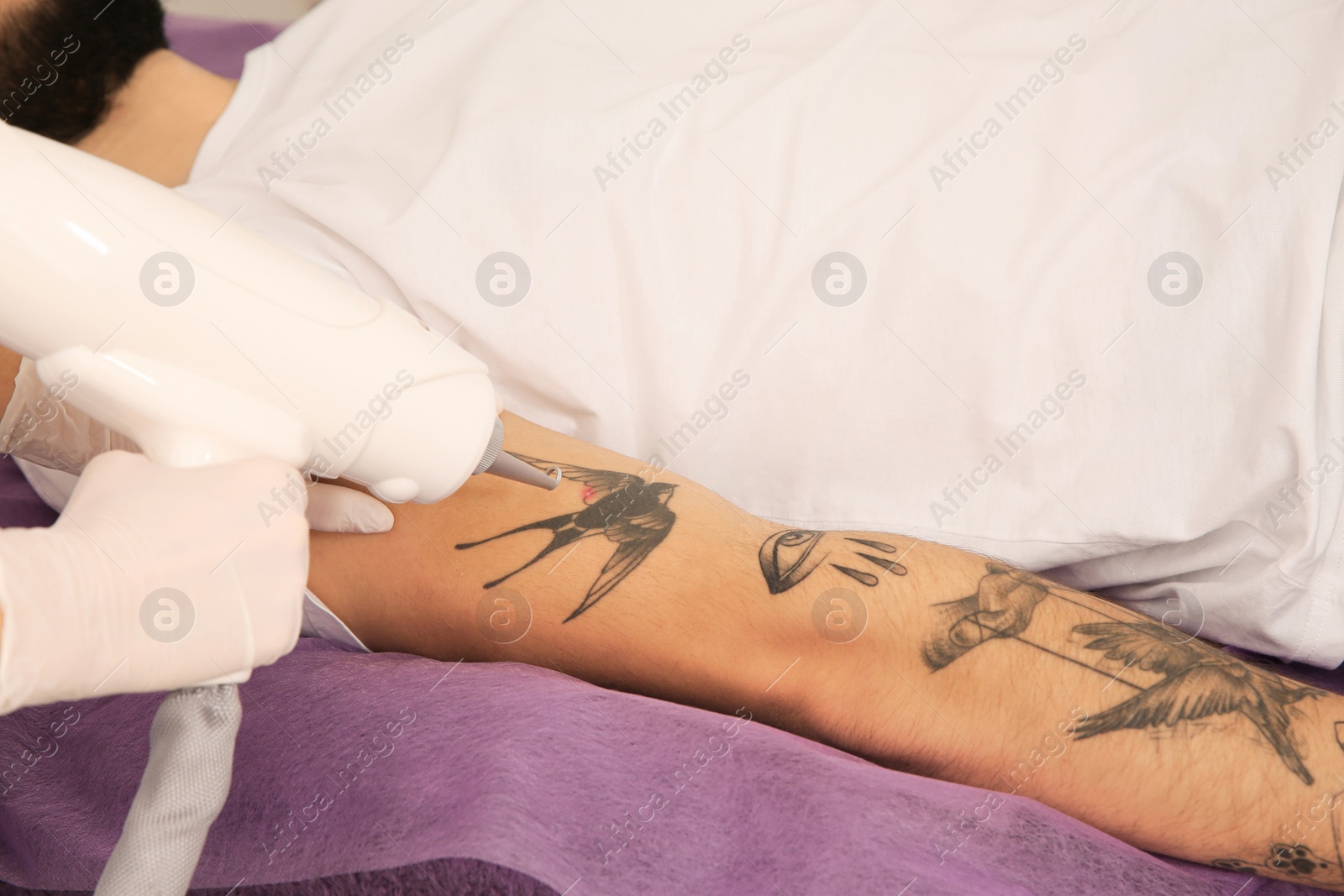 Photo of Young man undergoing laser tattoo removal procedure in salon, closeup