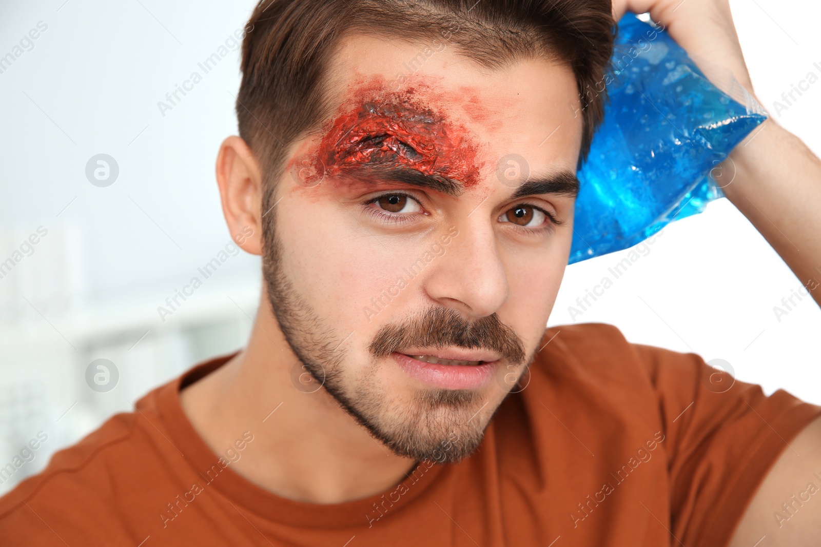 Photo of Young man with head injury in clinic. First aid