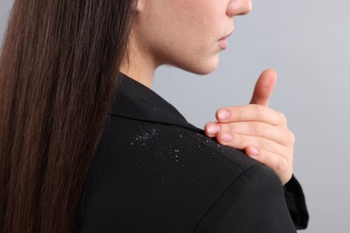 Woman brushing dandruff off her jacket against light grey background, closeup