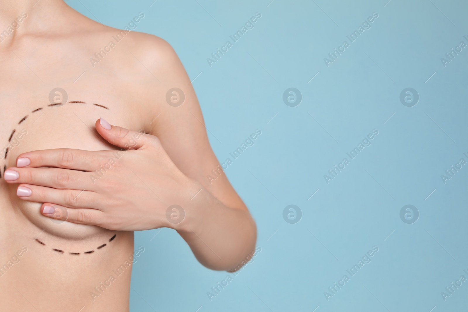 Photo of Young woman with marks on breast for cosmetic surgery operation against color background