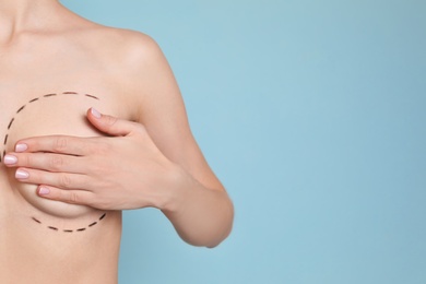 Young woman with marks on breast for cosmetic surgery operation against color background