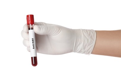 Scientist holding tube with blood sample and label Anti HAV on white background, closeup