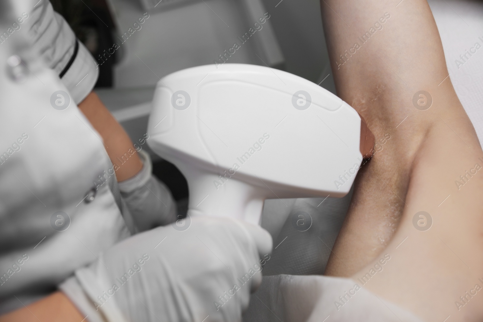 Photo of Woman undergoing laser epilation procedure, closeup view