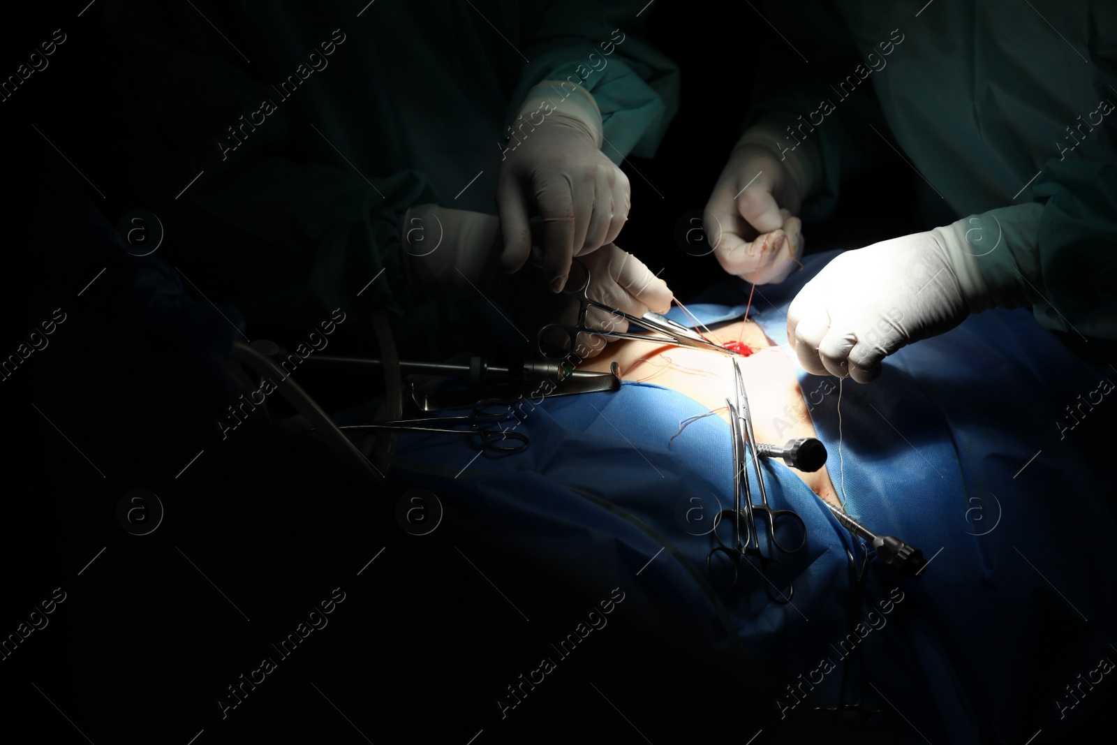 Photo of Medical team performing surgery in operating room, closeup