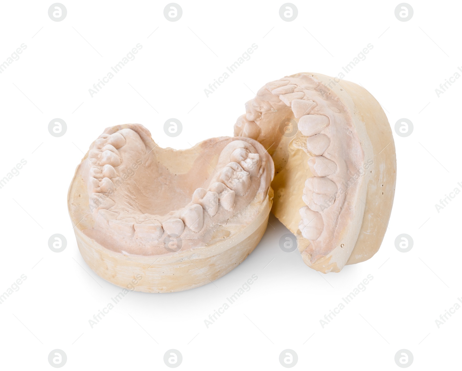 Photo of Dental model with jaws isolated on white. Cast of teeth