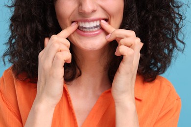 Young woman applying whitening strip on her teeth against light blue background, closeup