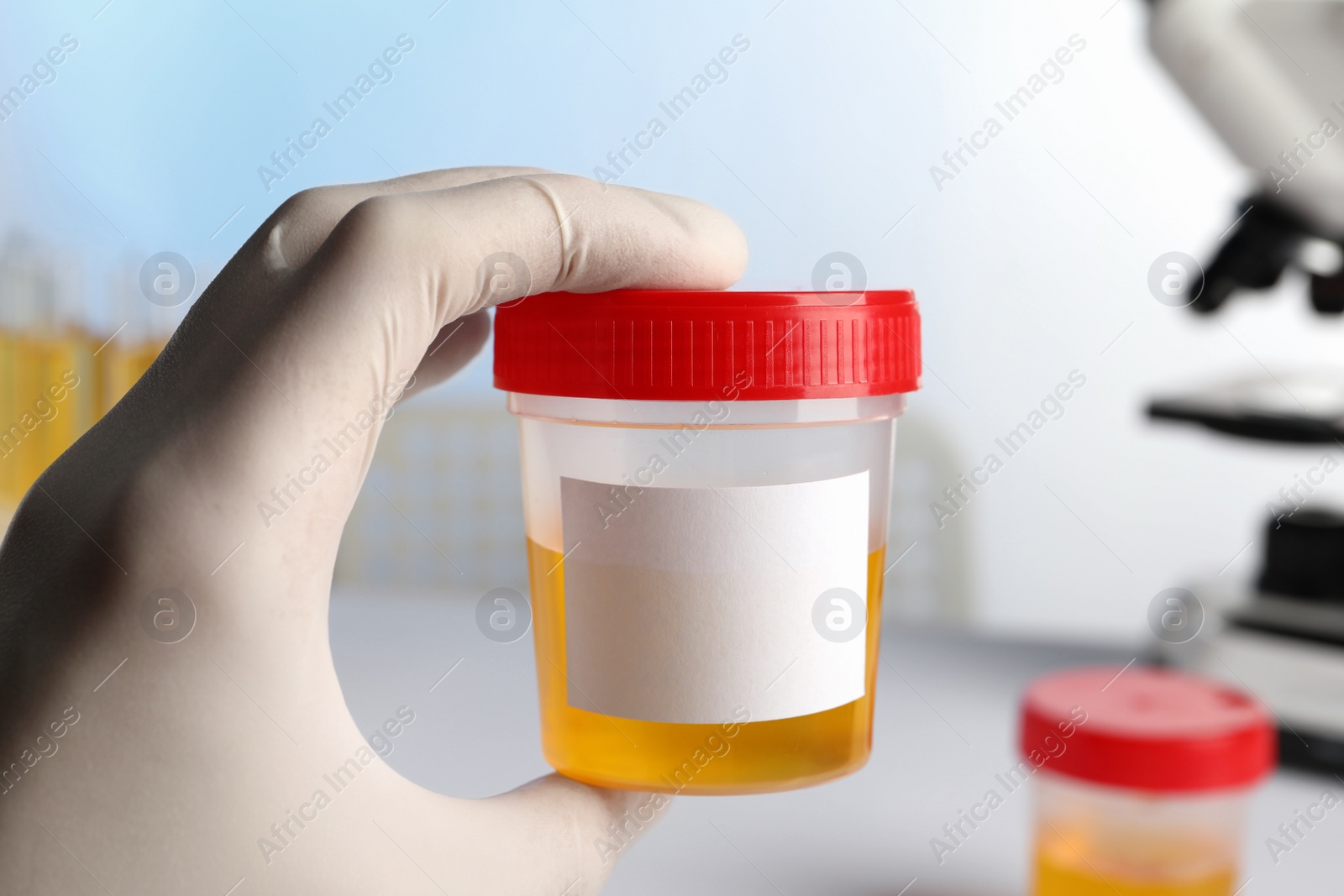 Photo of Nurse holding container with urine sample for analysis in laboratory, closeup