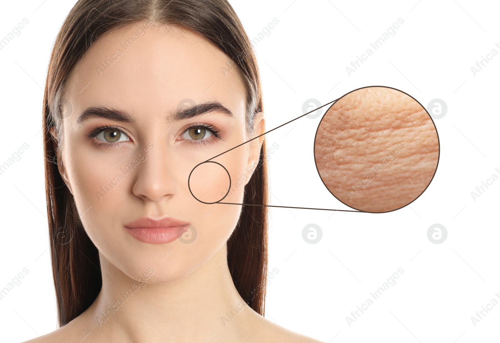 Image of Young woman with skin problem on white background