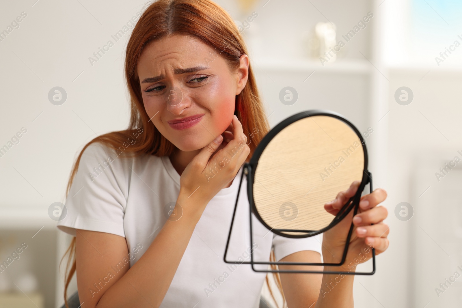 Photo of Suffering from allergy. Young woman looking in mirror and scratching her neck at home