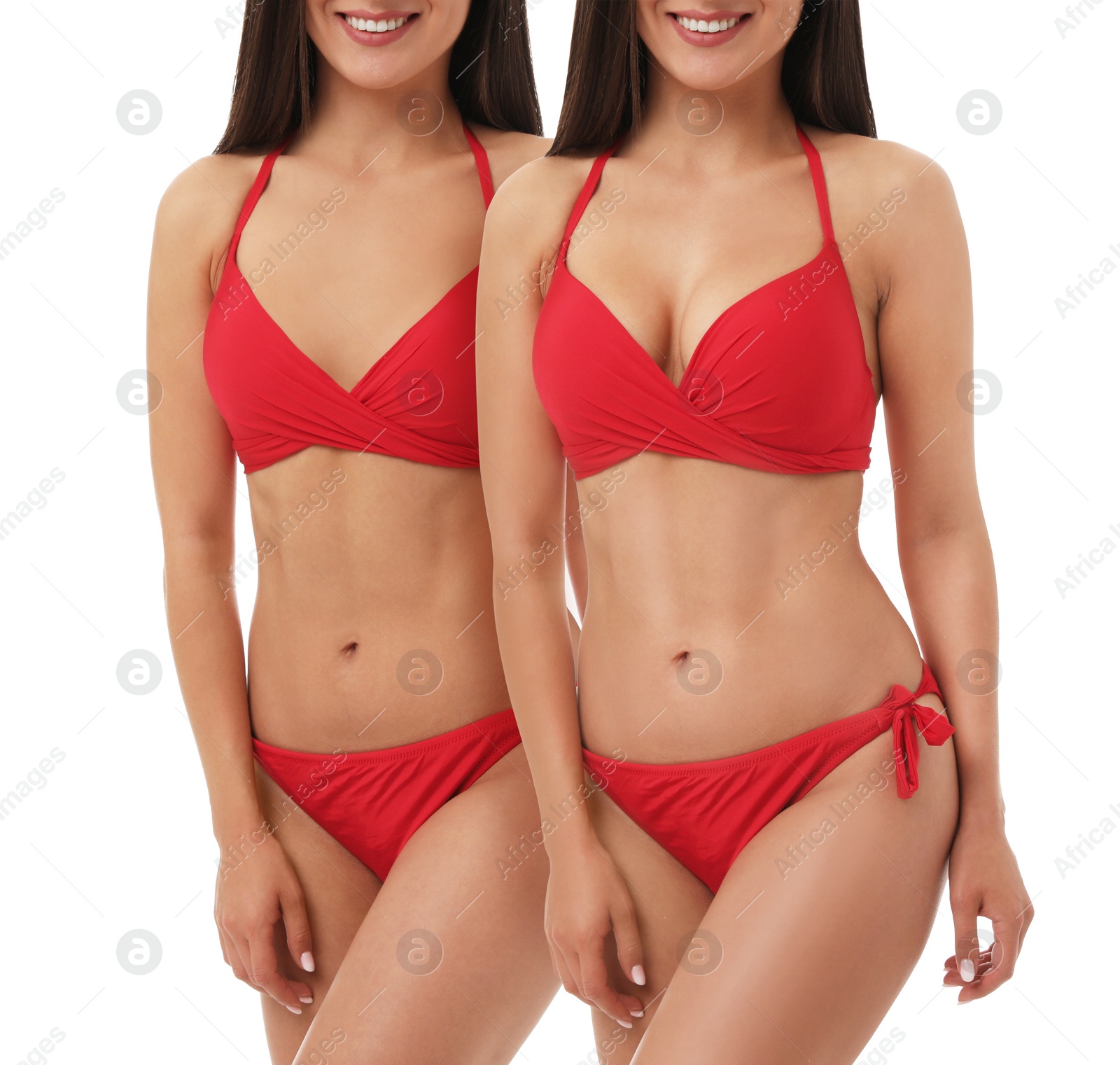 Image of Breast augmentation with silicone implants. Collage with photos of woman in swimsuit before and after plastic surgery on white background, closeup