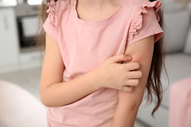 Photo of Little girl scratching arm at home, closeup. Annoying itch