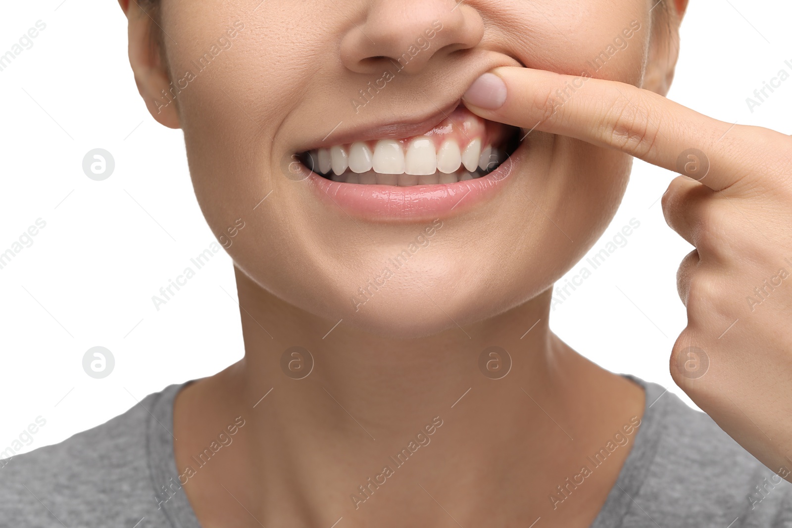 Photo of Woman showing her clean teeth on white background, closeup