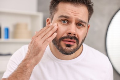Photo of Skin problem. Confused man touching his face at home