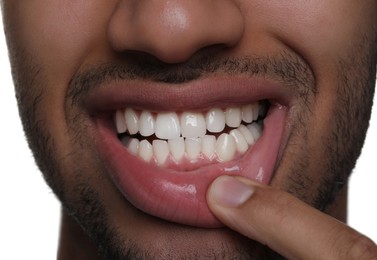 Photo of Man showing healthy gums on white background, closeup