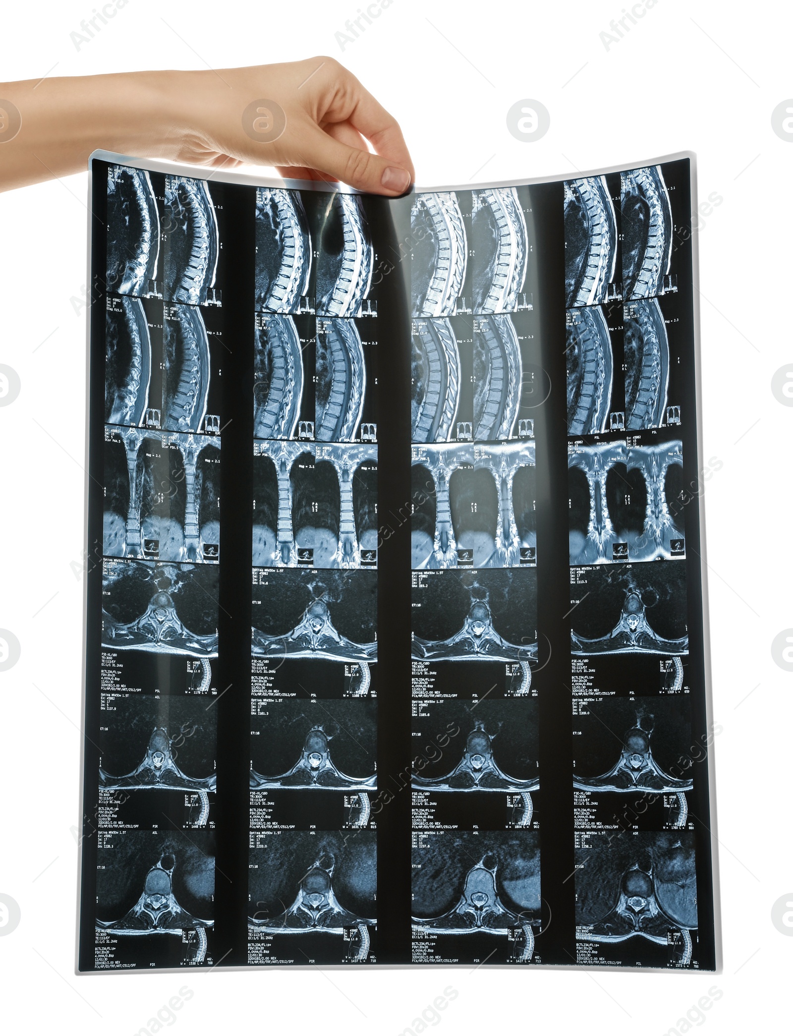 Photo of Doctor examining neck MRI image on white background, closeup