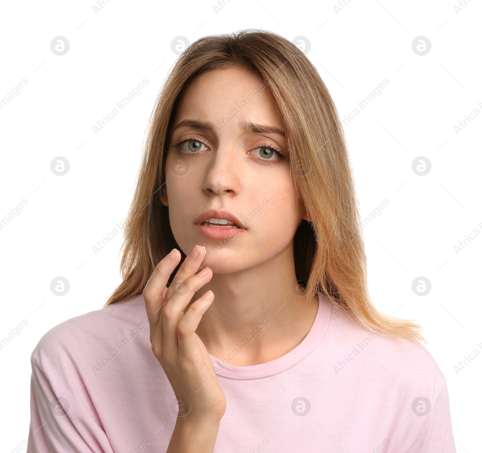 Photo of Woman with herpes applying cream onto lip against white background