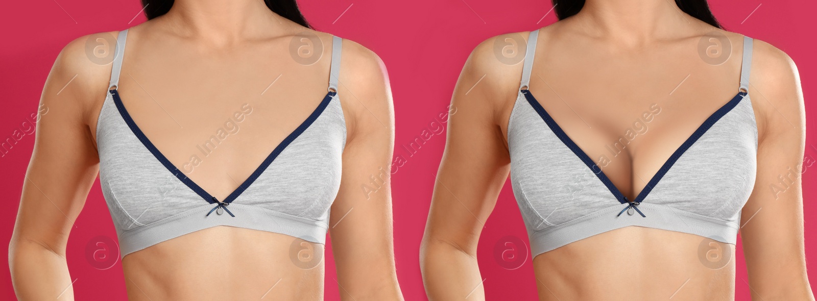 Image of Collage with photos of young woman before and after breast size correction on color background, closeup. Banner design