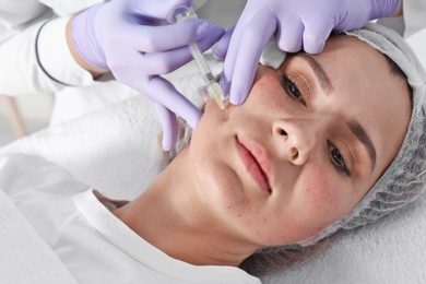 Photo of Woman undergoing face biorevitalization procedure in salon, closeup. Cosmetic treatment