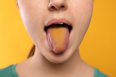 Photo of Gastrointestinal diseases. Woman showing her yellow tongue on color background, closeup