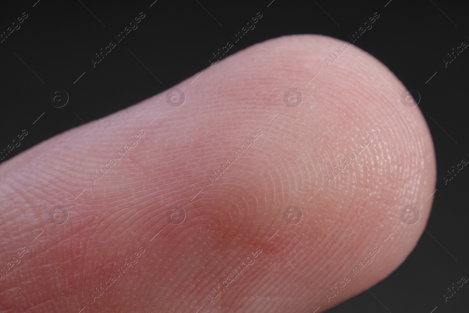 Photo of Finger with friction ridges on dark background, macro view