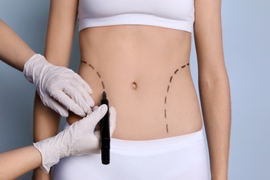 Photo of Doctor drawing marks on female belly for cosmetic surgery operation, closeup