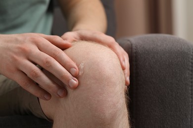 Man applying ointment onto his knee indoors, closeup