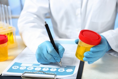 Laboratory assistant with urine sample for analysis writing medical report at table, closeup