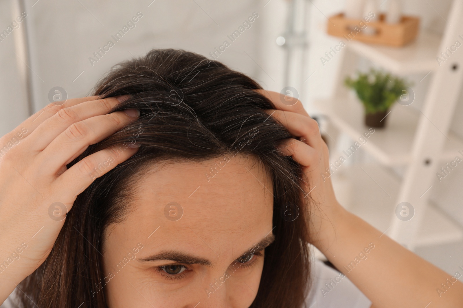 Photo of Mature woman suffering from baldness at home, closeup