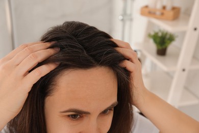 Photo of Mature woman suffering from baldness at home, closeup