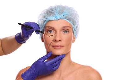 Image of Woman preparing for cosmetic surgery, white background. Doctor drawing markings on her face, closeup