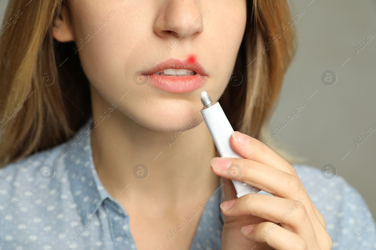 Image of Woman with herpes applying cream onto lip on light grey background, closeup