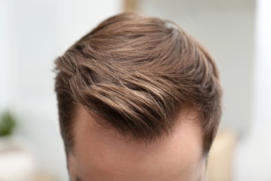 Young man with hair loss problem indoors, closeup