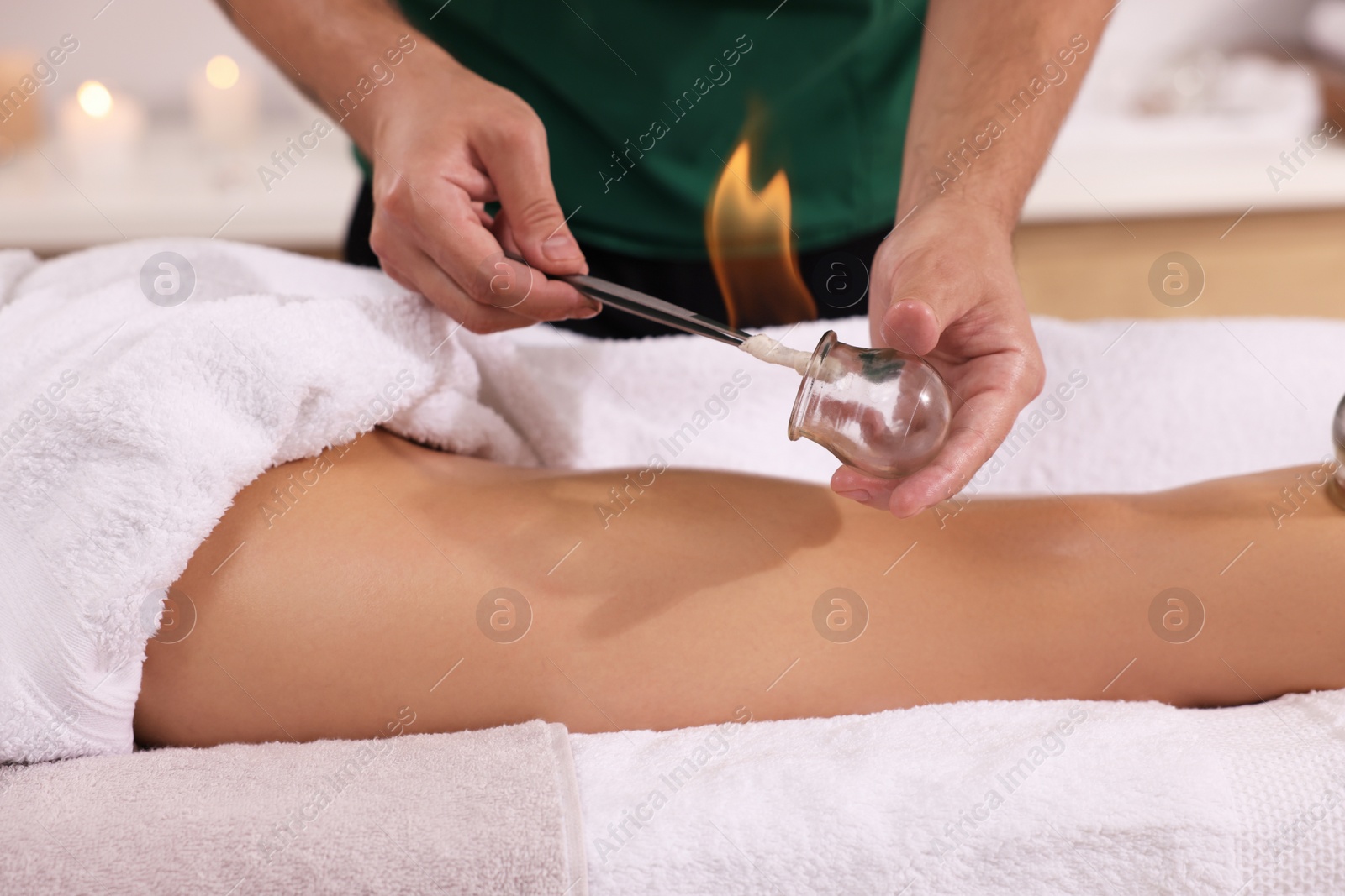 Photo of Therapist giving fire cupping treatment to patient indoors, closeup