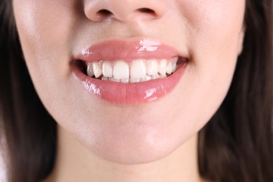 Photo of Young smiling woman with healthy teeth, closeup