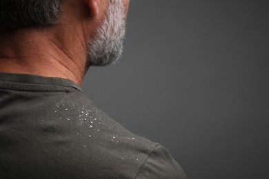 Bearded man with dandruff on his t-shirt against grey background, closeup. Space for text