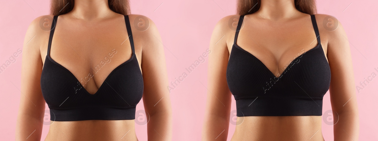 Image of Collage with photos of woman before and after breast-lift surgery on pink background, closeup