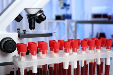 Photo of Test tubes with blood samples in laboratory. Research and analysis