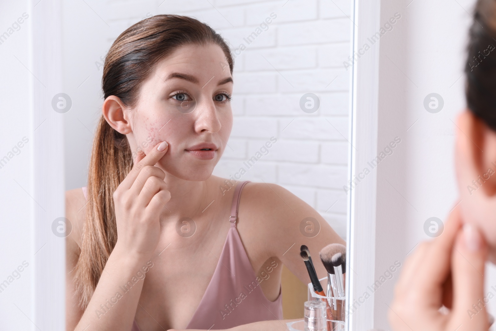 Photo of Woman with acne problem near mirror indoors