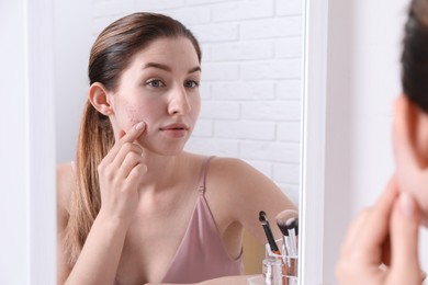 Woman with acne problem near mirror indoors