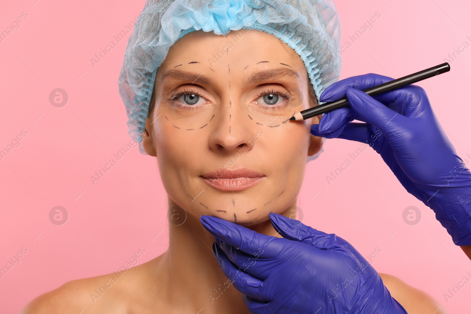 Photo of Doctor with pencil preparing patient for cosmetic surgery operation on pink background, closeup