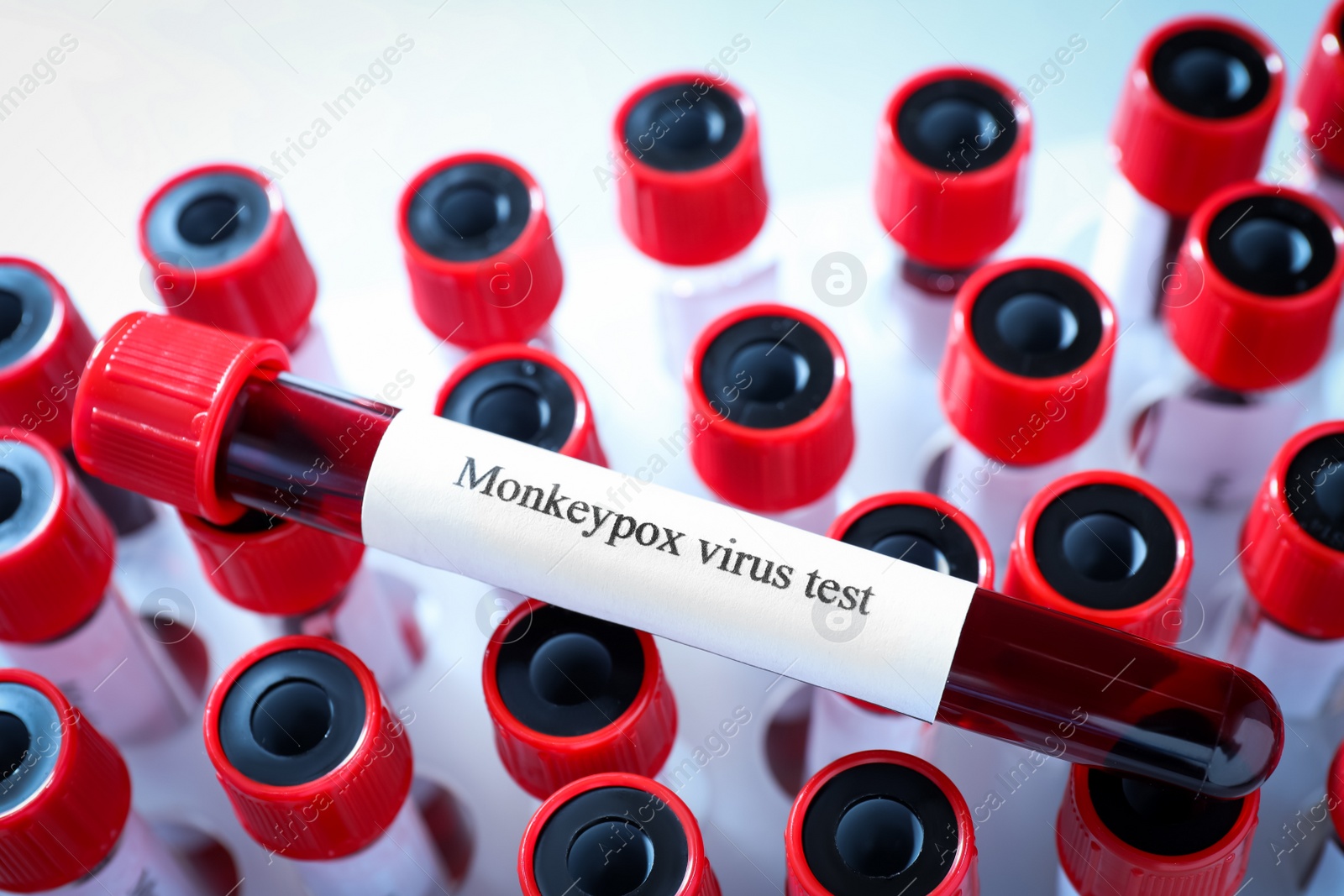 Photo of Monkeypox virus test. One sample tube with blood on others, closeup