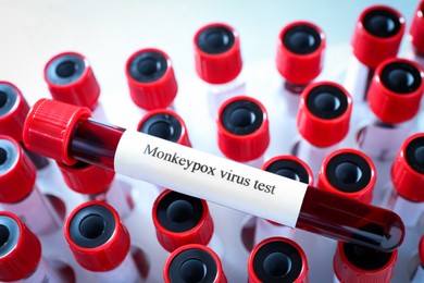 Monkeypox virus test. One sample tube with blood on others, closeup