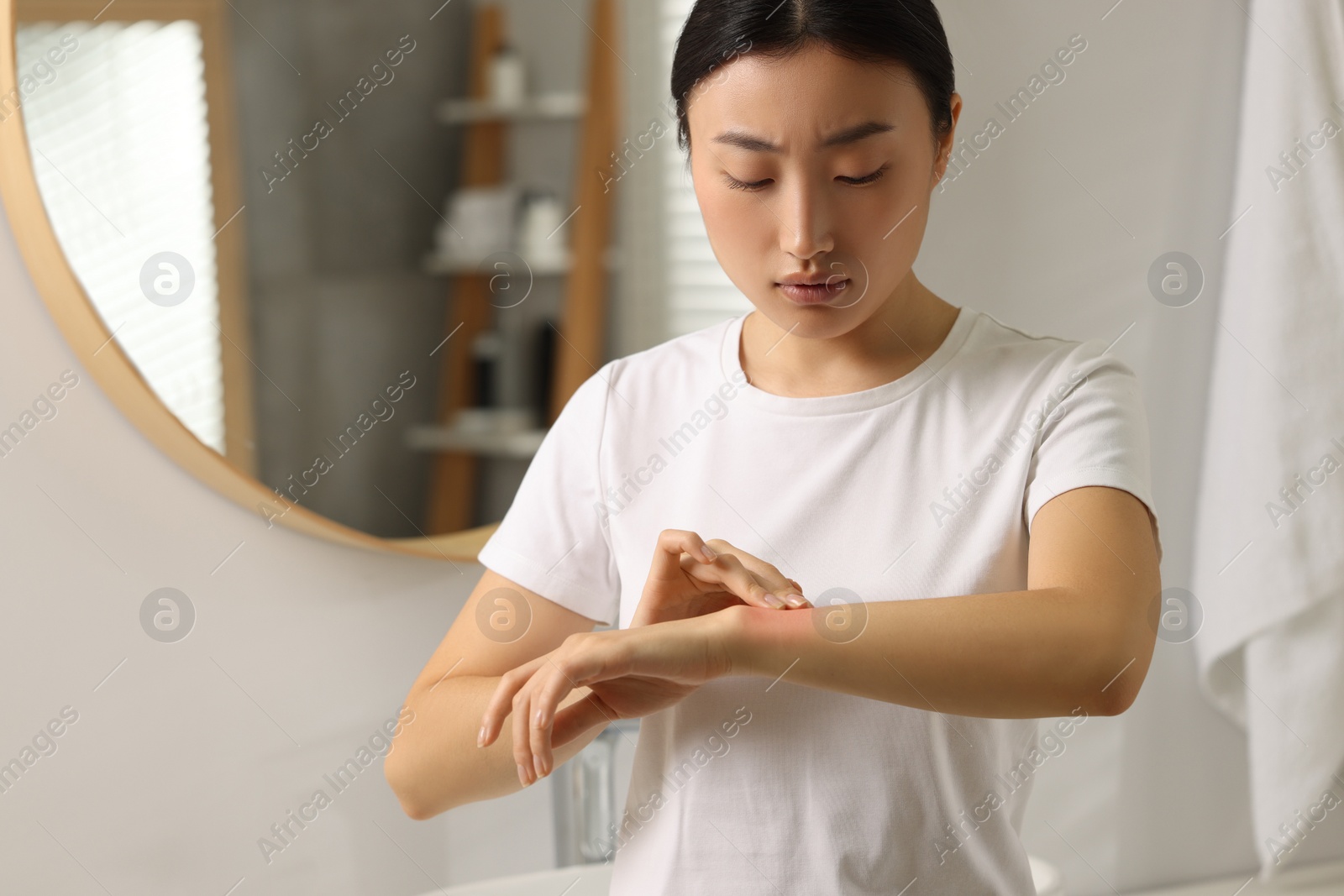 Photo of Suffering from allergy. Young woman scratching her arm in bathroom