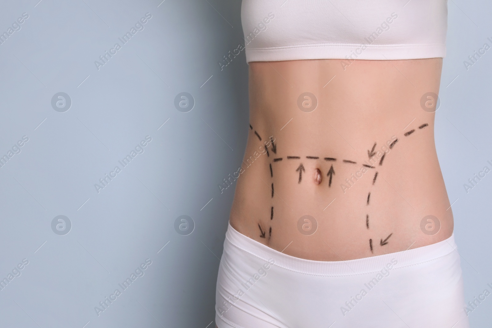 Photo of Young woman with marks on belly for cosmetic surgery operation against color background