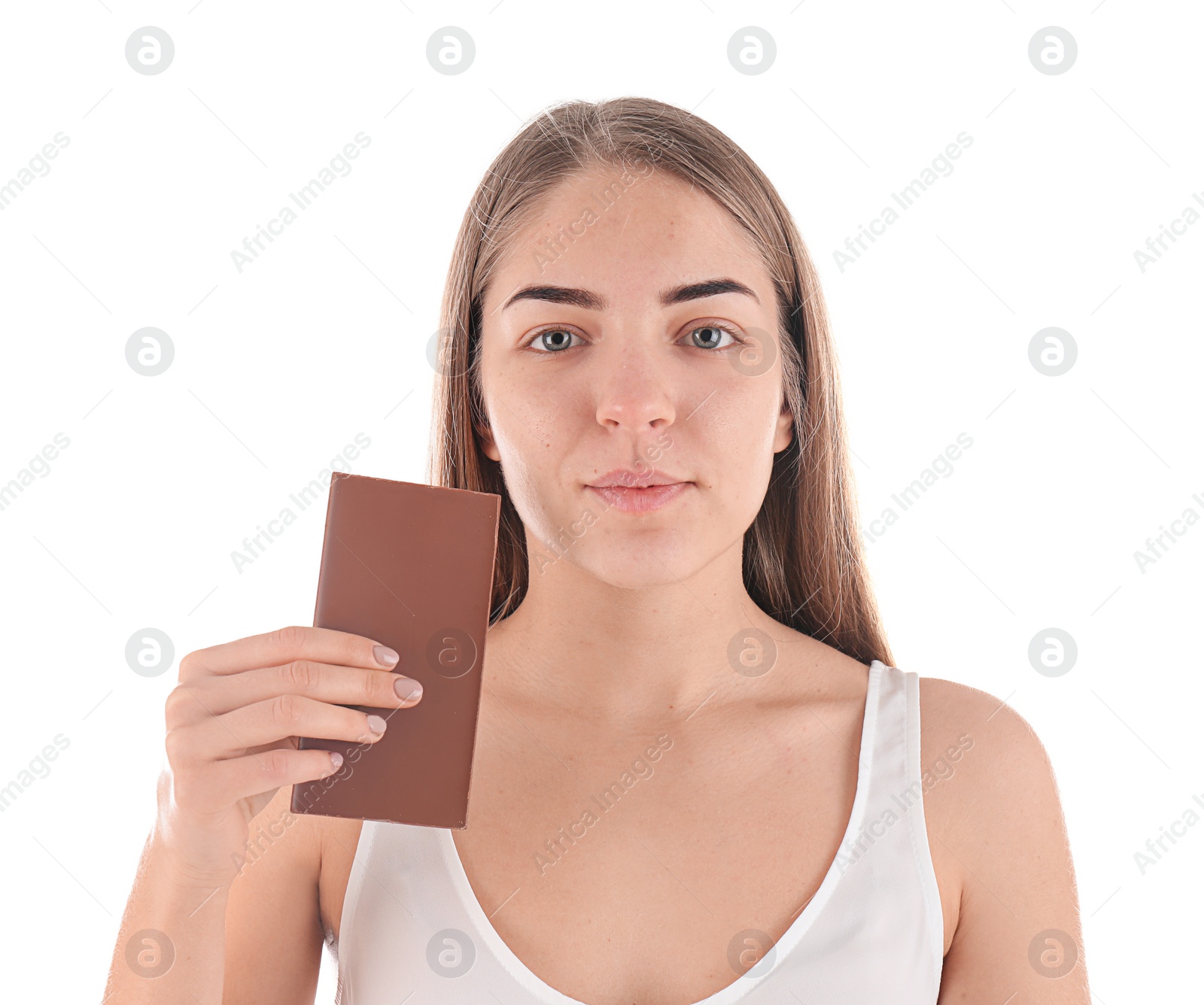 Photo of Young woman with acne problem holding chocolate bar on white background. Skin allergy