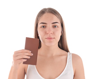 Young woman with acne problem holding chocolate bar on white background. Skin allergy