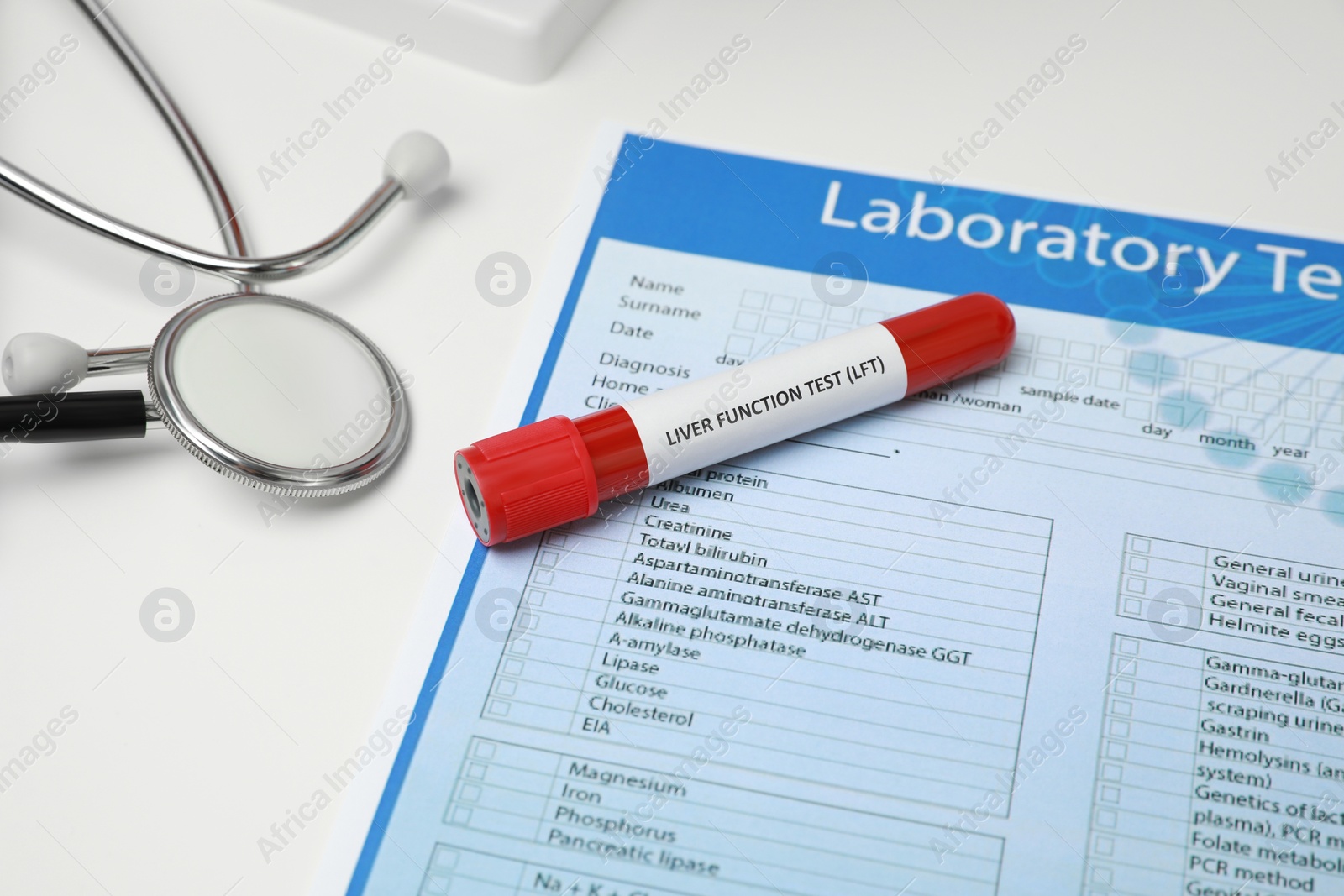 Photo of Liver Function Test. Tube with blood sample, form and stethoscope on white table