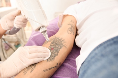 Young man undergoing laser tattoo removal procedure in salon, closeup